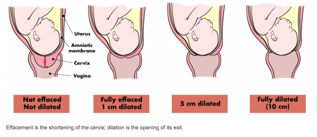 cervix opening during labor