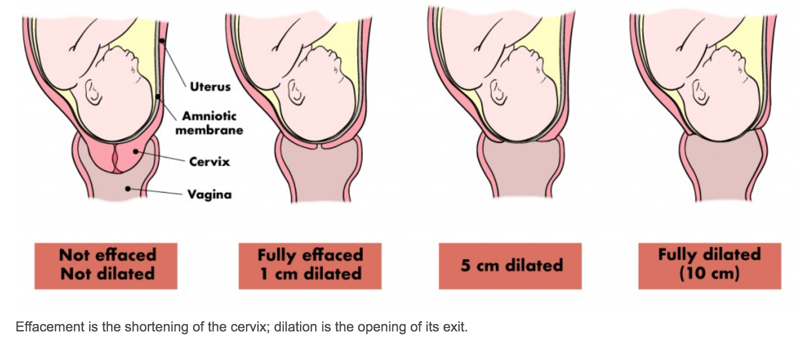 contraction timing active labor