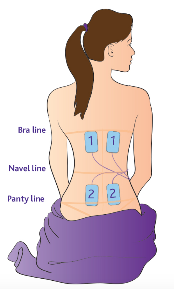 Electrode Placement Guidelines, TENS Electrode Chart