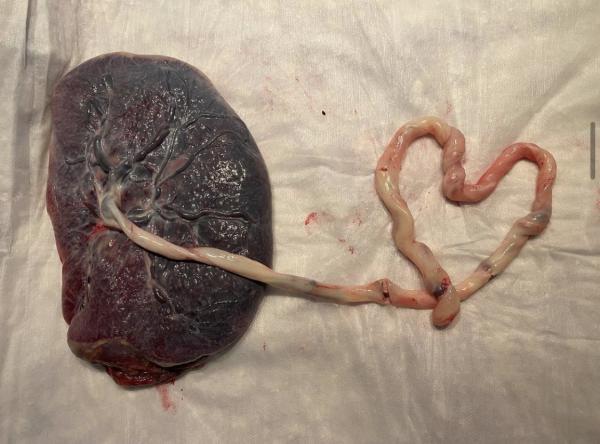Placenta Art